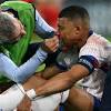 Mbappe nez cassé